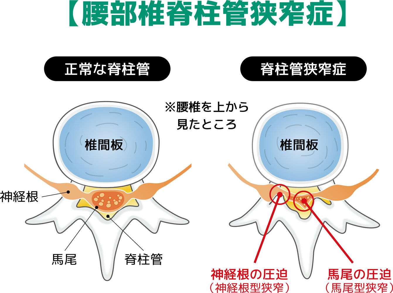 画像3487