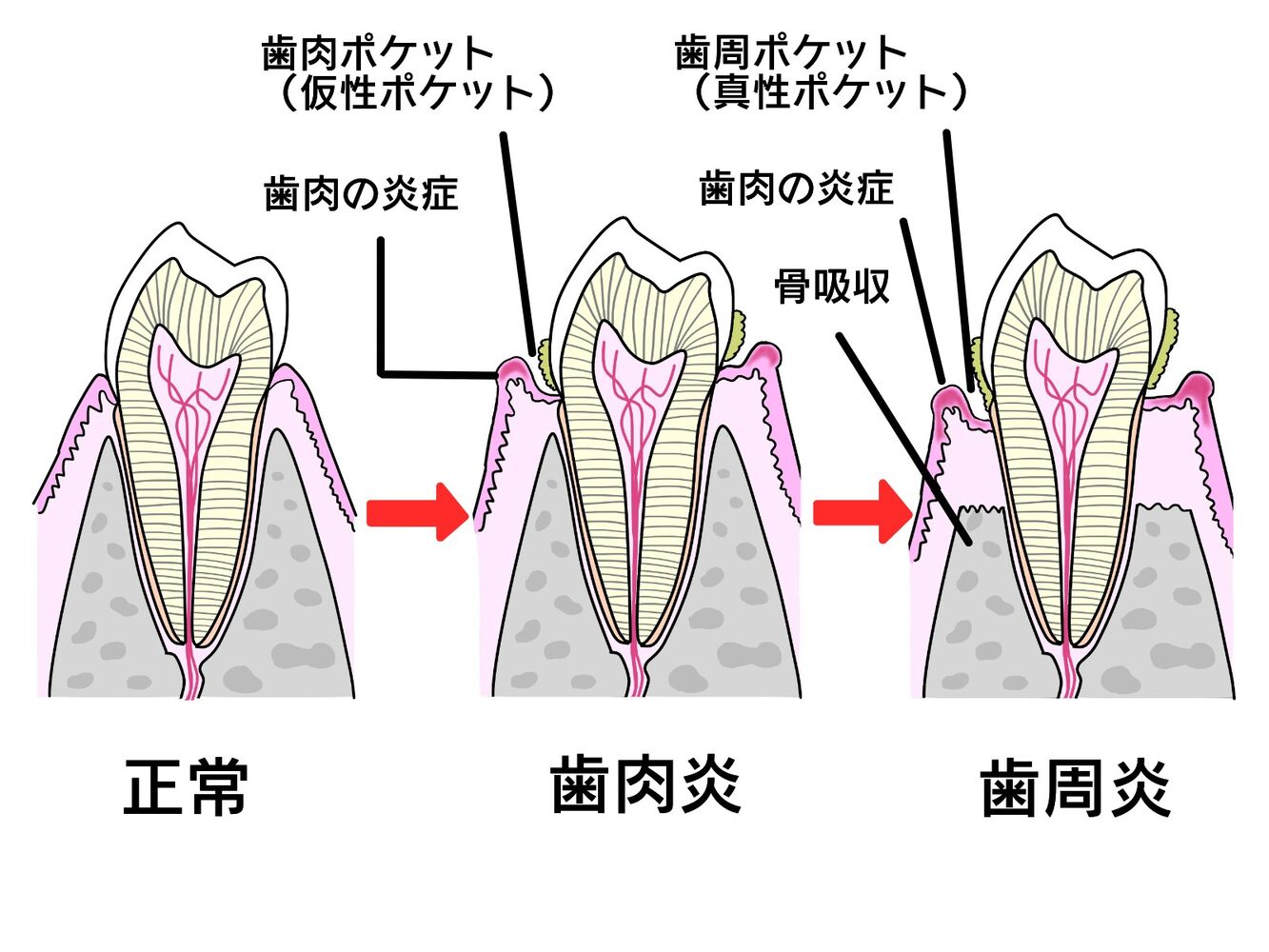 画像3857